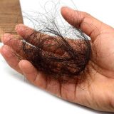 Have you witnessed an increase in the number of post-COVID patients with hair loss?